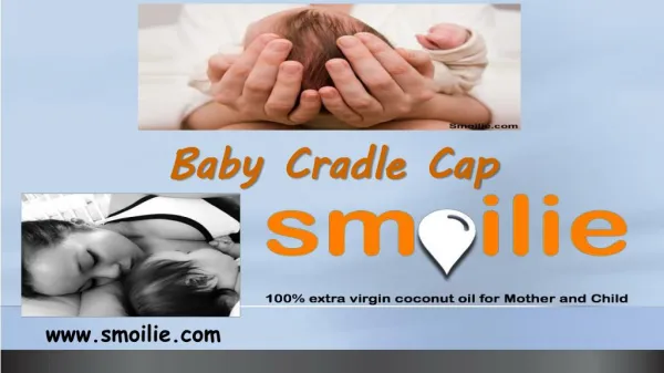 Baby cradle cap