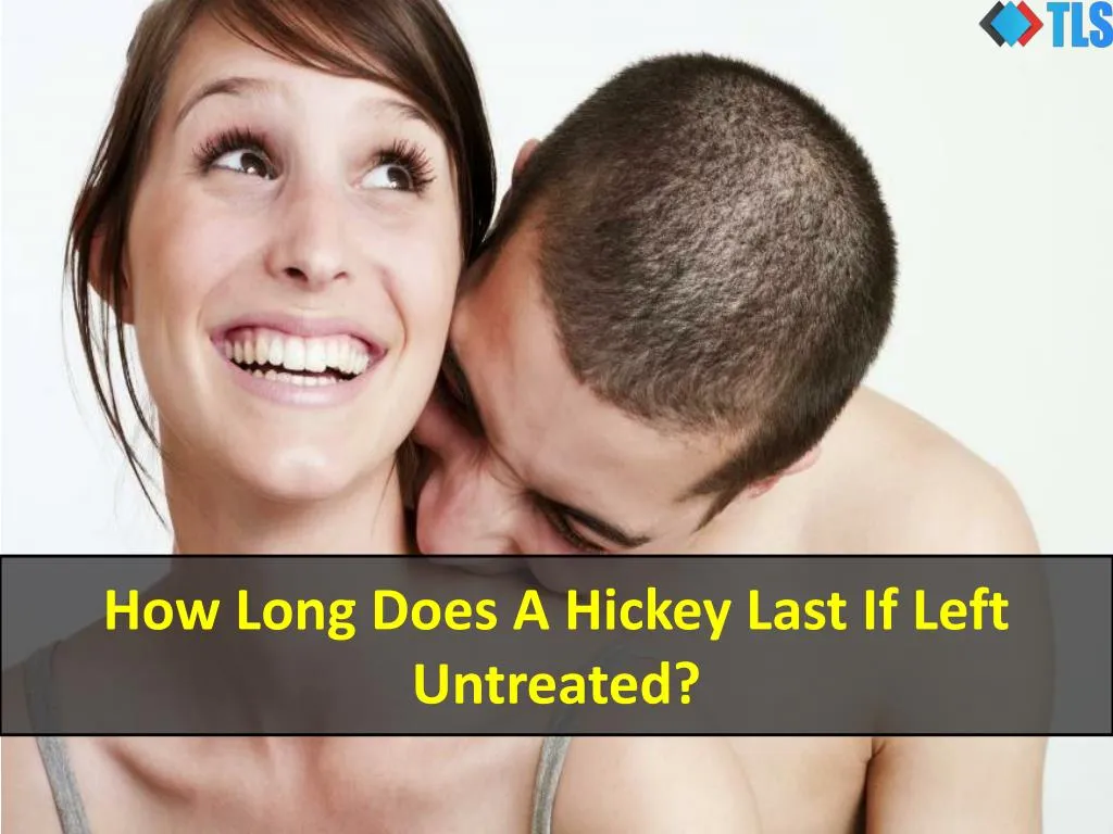 how long does a hickey last if left untreated