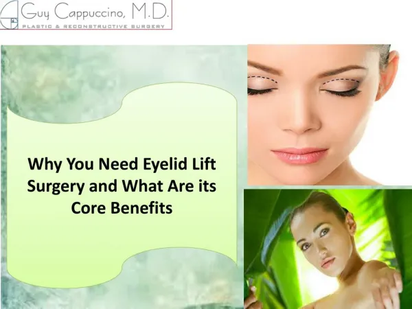 Why You Need Eyelid Lift Surgery and What Are its Core Benefits