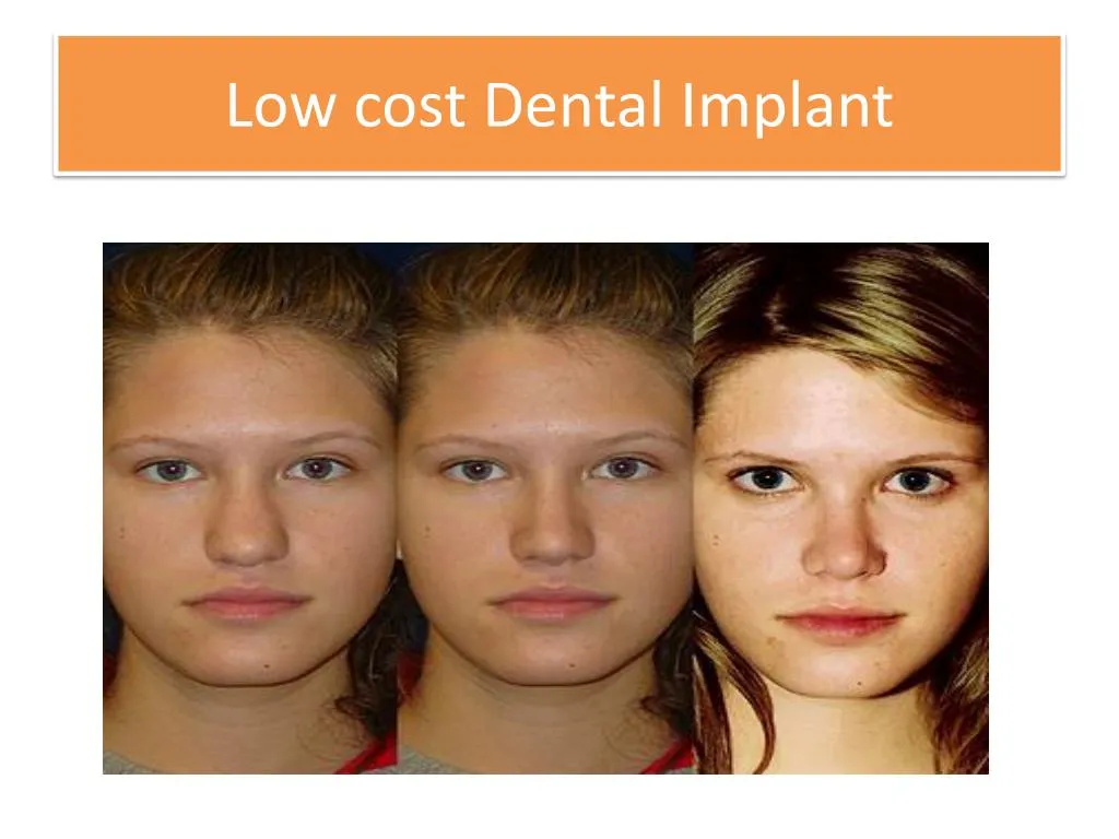 low cost dental implant
