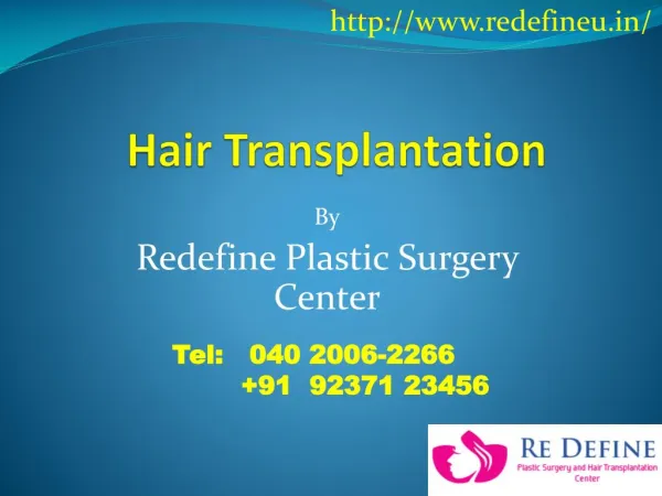 Best Hair Transplantation Cost in Hyderabad | Hair Transplant in Hyderabad