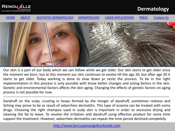 Seborrheic Dermatit