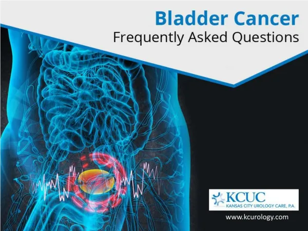 Bladder Cancer - Questions and Detailed Answers!