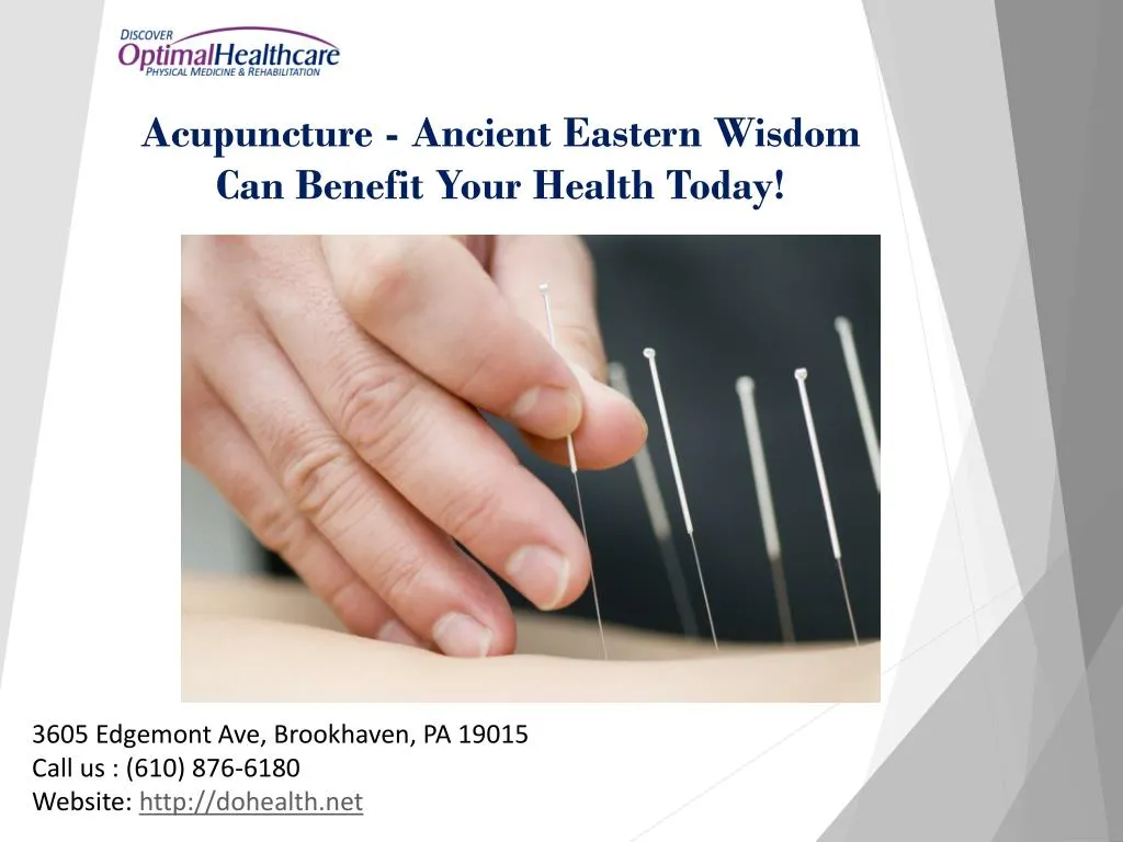 acupuncture ancient eastern wisdom can benefit your health today