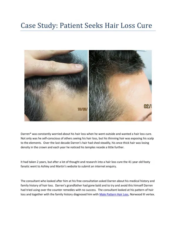 Case Study - Patient Seeks Hair Loss Cure