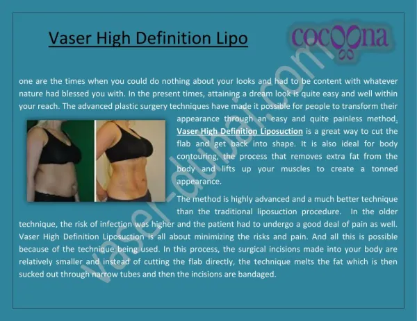 Vaser High Definition Lipo