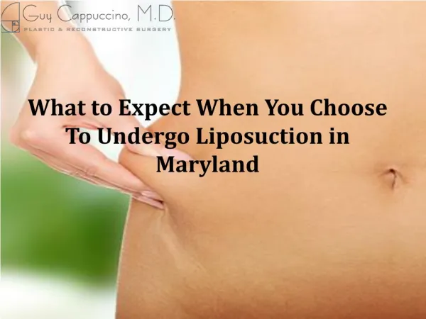 What to Expect When You Choose To Undergo Liposuction in Maryland