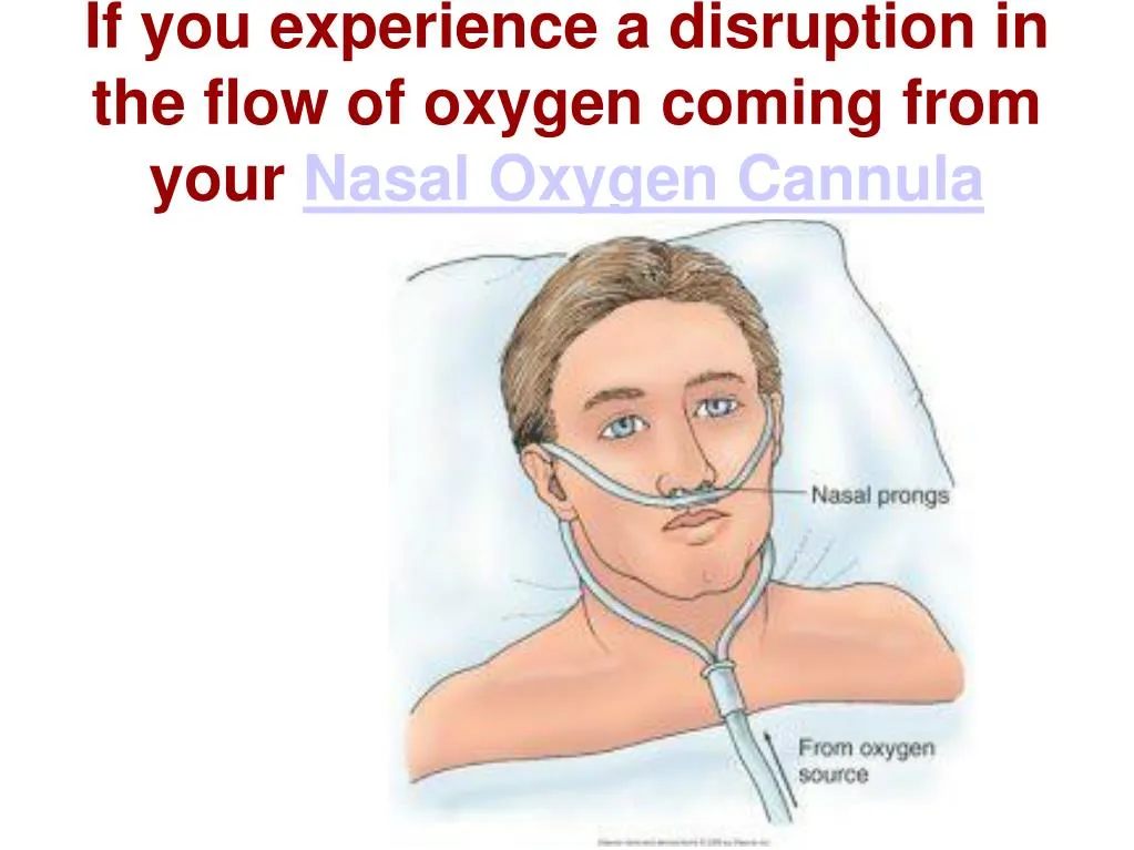 if you experience a disruption in the flow of oxygen coming from your nasal oxygen cannula
