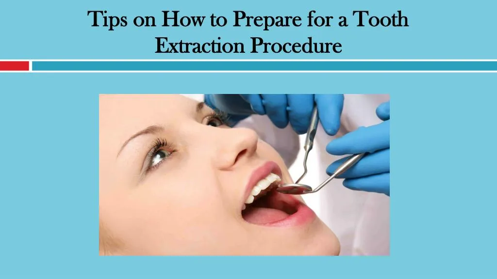 tips on how to prepare for a tooth extraction procedure