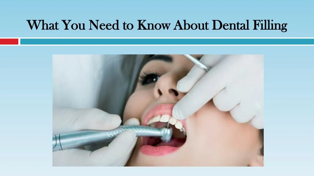 what you need to know about dental filling