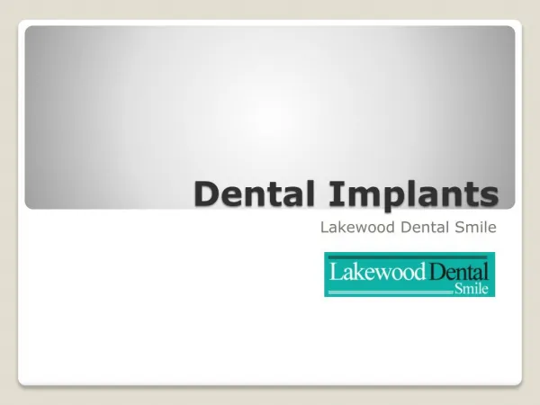 Dental implants Michigan