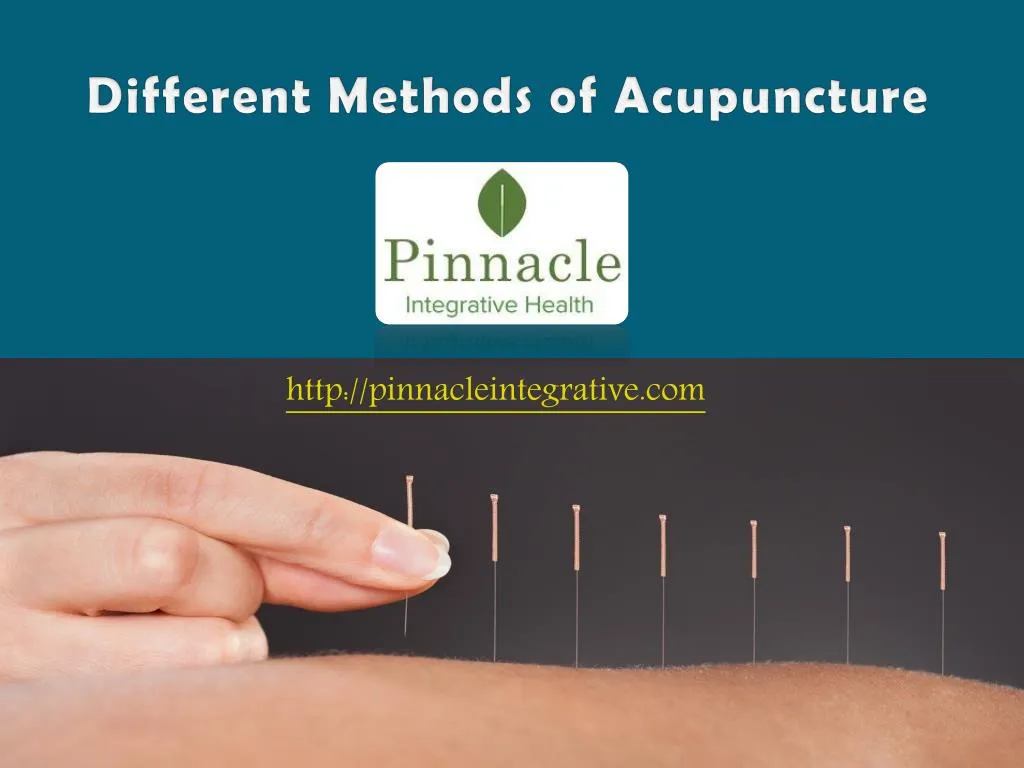 different methods of acupuncture