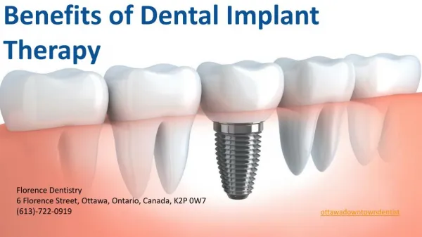 Benefits of Dental Implant Therapy