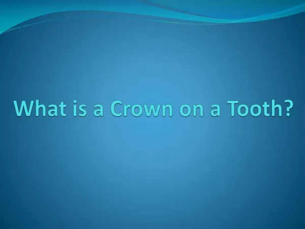 What is a Crown on a Tooth?