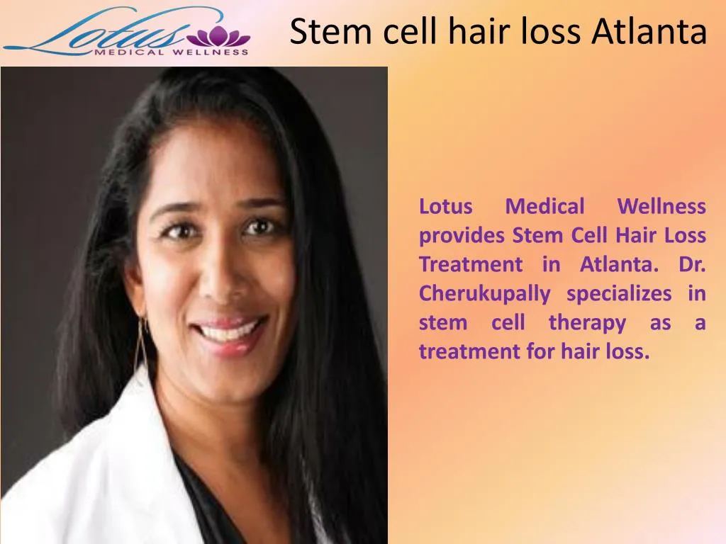 stem cell hair loss atlanta