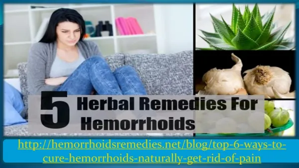 Top 5 Home Remedies for Hemorrhoid Relief