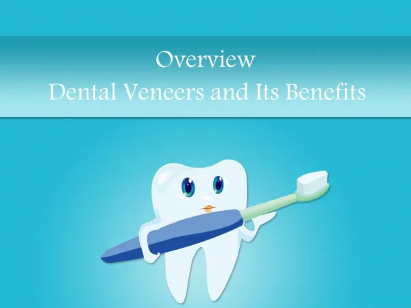 An In-Depth Overview of Dental Veneers