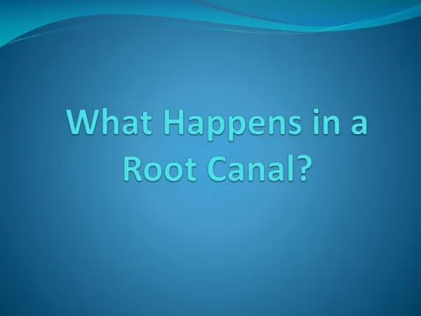 What Happens in a Root Canal?