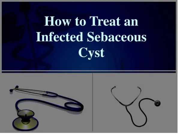 How to Treat an Infected Sebaceous Cyst