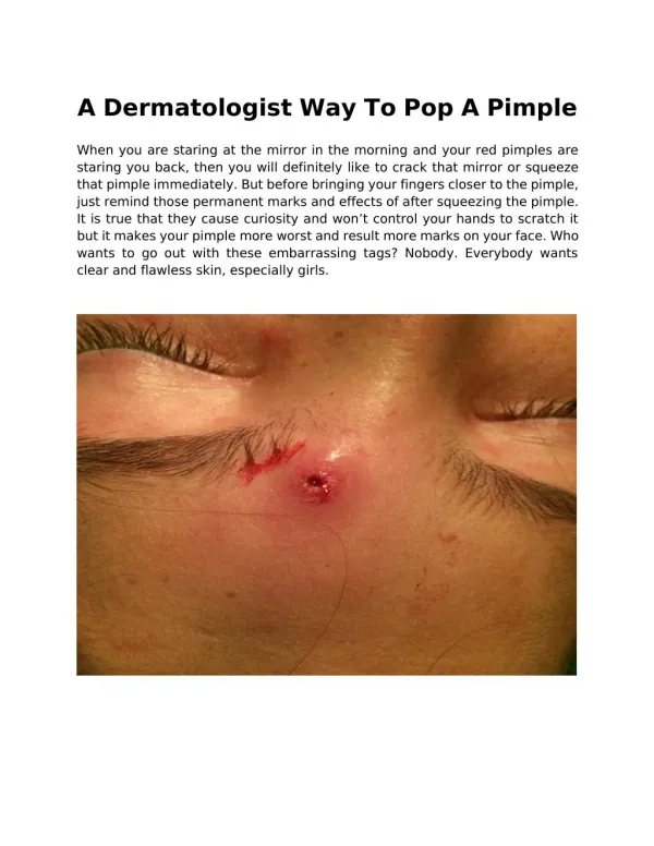 A Dermatologist Way To Pop A Pimple