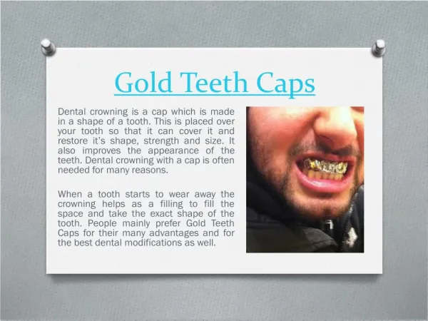 Gold Teeth Caps