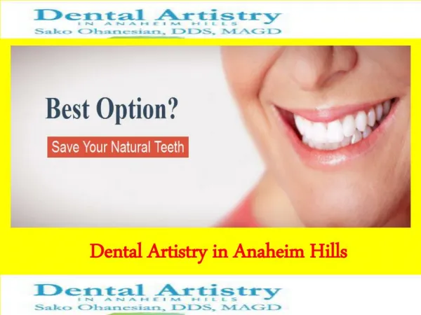 Dental Implant Orange County