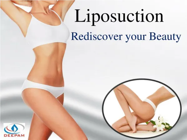 Liposuction - get the sculpted look