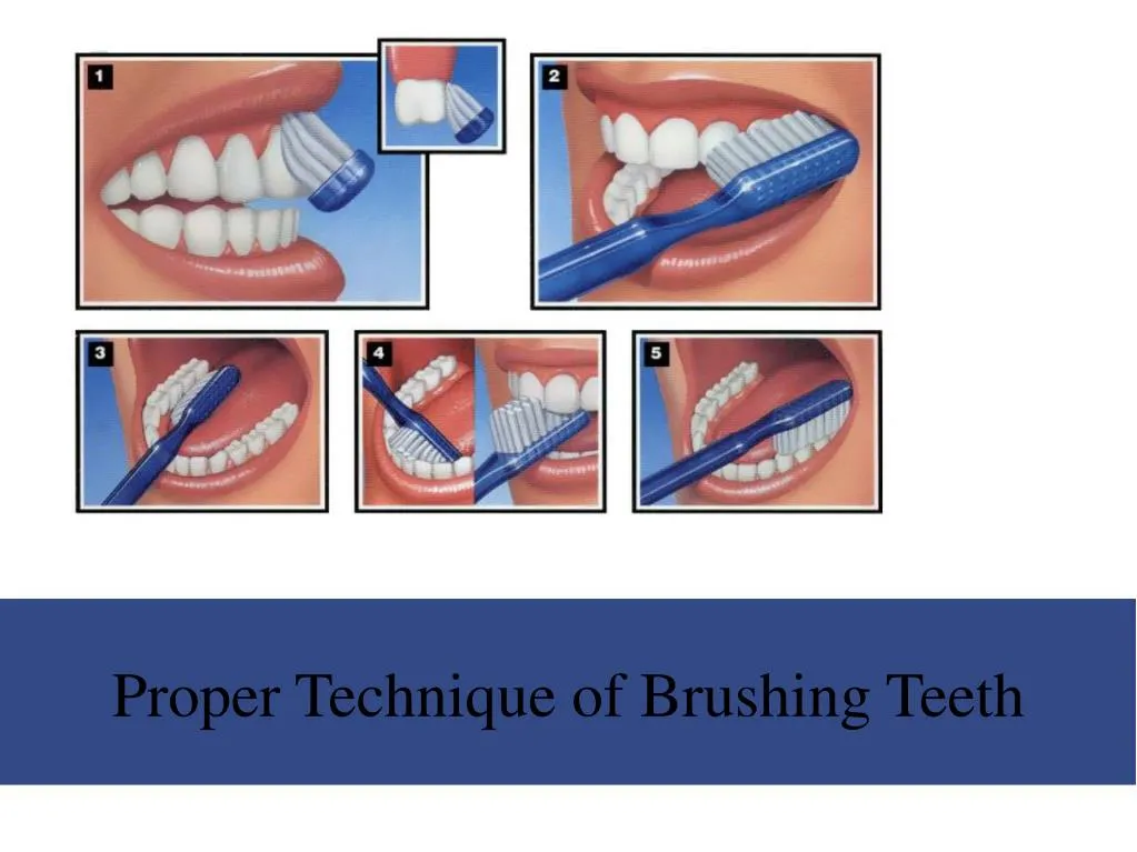 proper technique of brushing teeth
