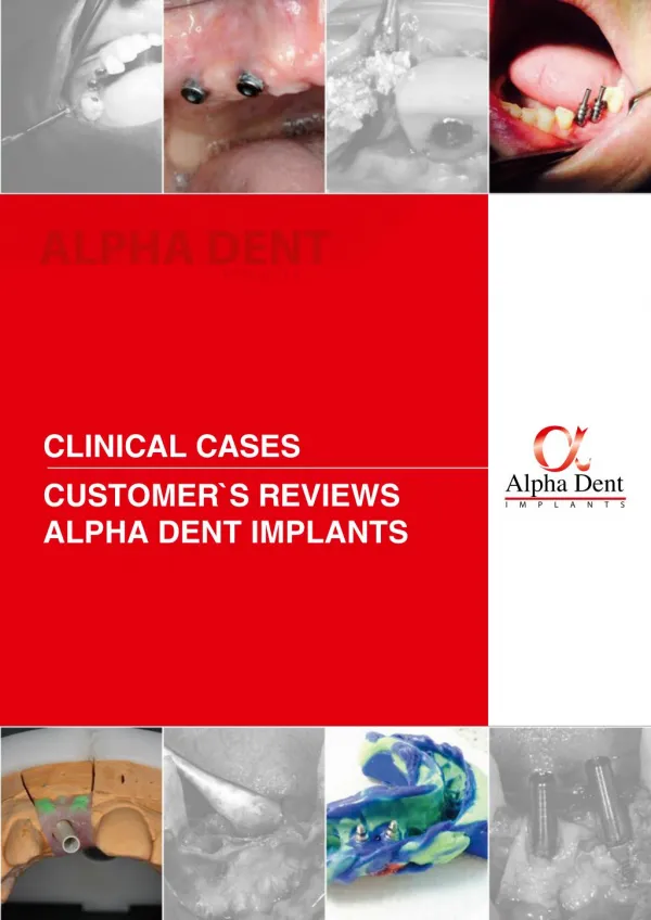 Alpha Dent Implants clinical cases and customer's reviews