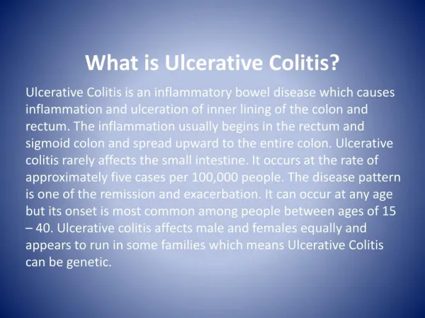 Best Treatment for Ulcerative Colitis: Ulcerativecolitiscure