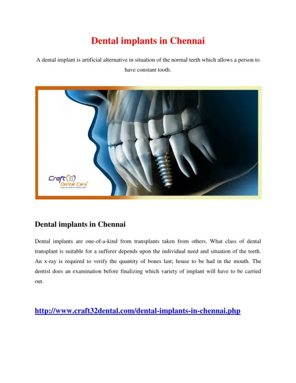 Dental implants in Chennai