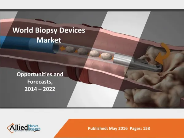 2022 Biopsy Devices Industry Growth & Opportunities
