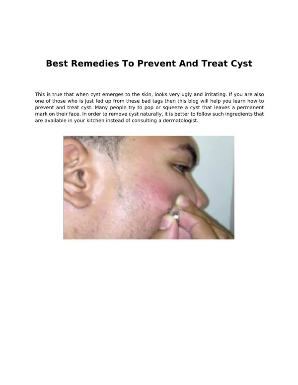 Best Remedies To Prevent And Treat Cyst