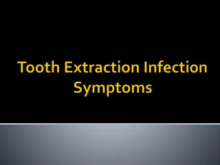 PPT - Tooth Extraction With Comfort Tooth Extraction Salt Lake ...