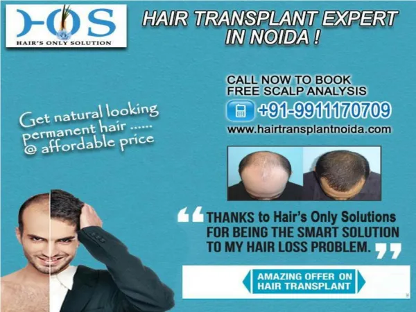 Hair transplant expert in noida