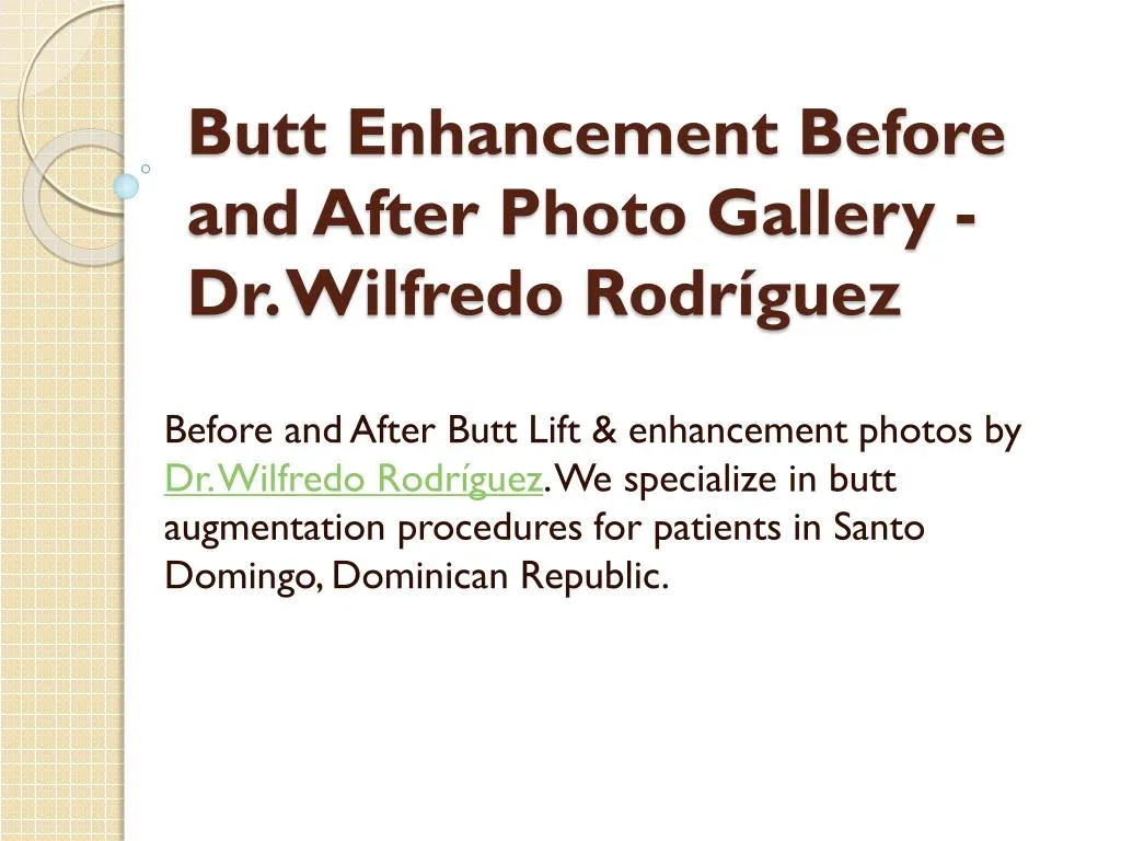 butt enhancement before and after photo gallery dr wilfredo rodr guez