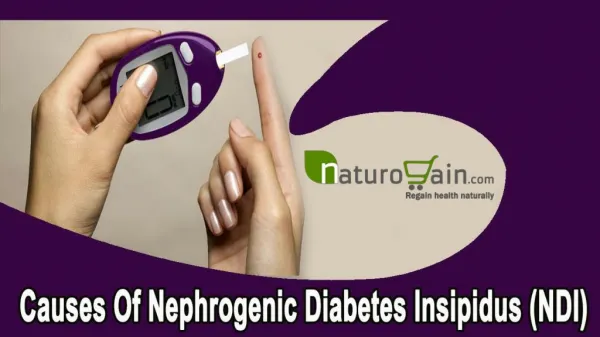 Causes Of Nephrogenic Diabetes Insipidus (NDI)