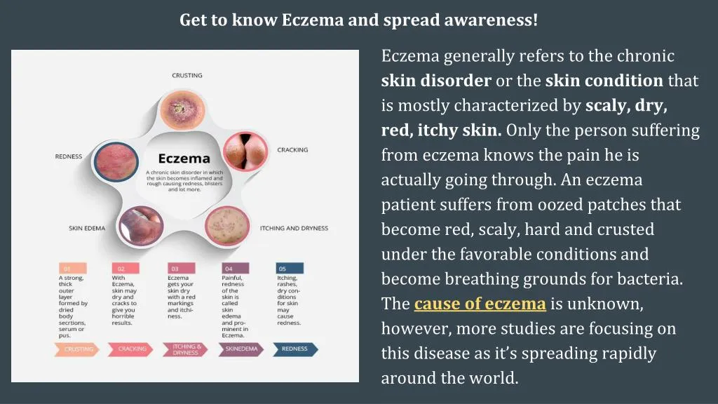 get to know eczema and spread awareness