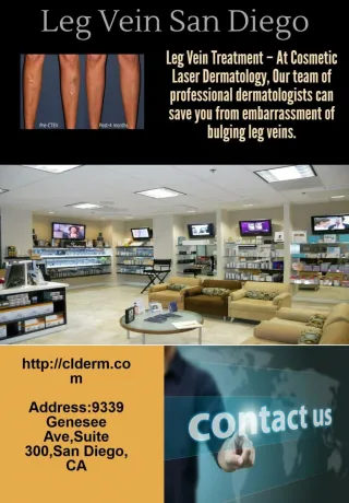 Leg Vein - slide 1
