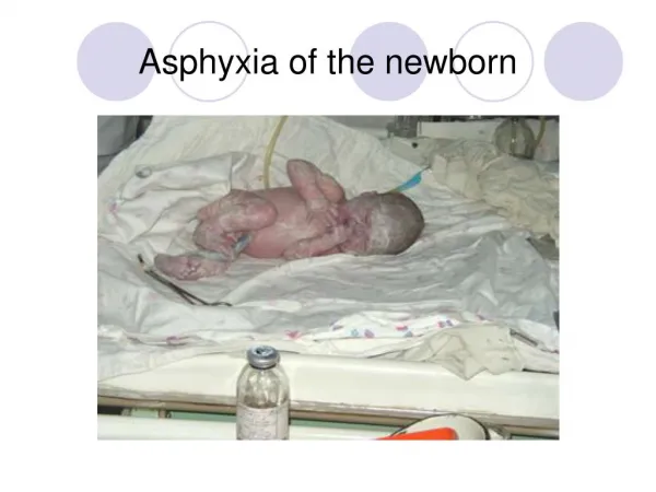 ASPHYXIA IN NEWBORN