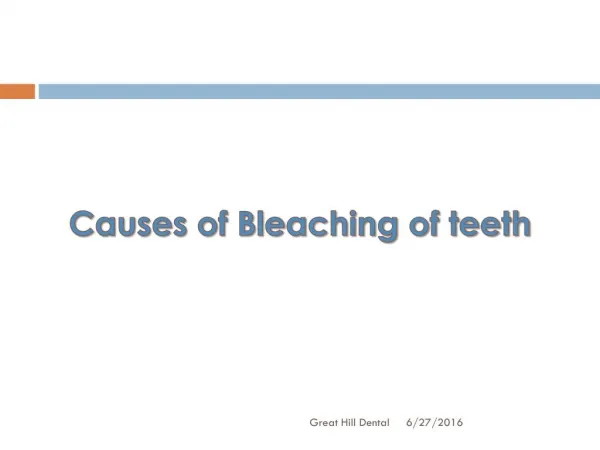 Causes of Bleaching of teeth