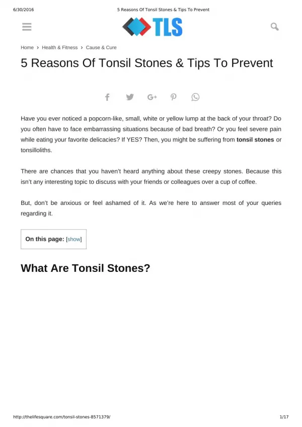 5 Reasons Of Tonsil Stones & Tips To Prevent