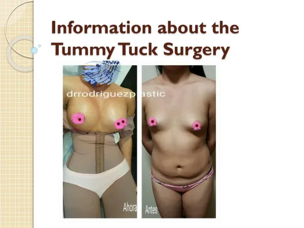 Information about the Tummy Tuck Surgery