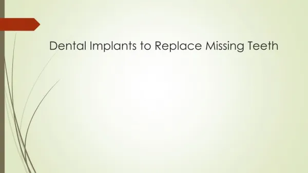 Dental Implants to Replace Missing Teeth