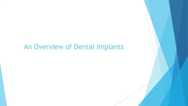 An overview of dental implants