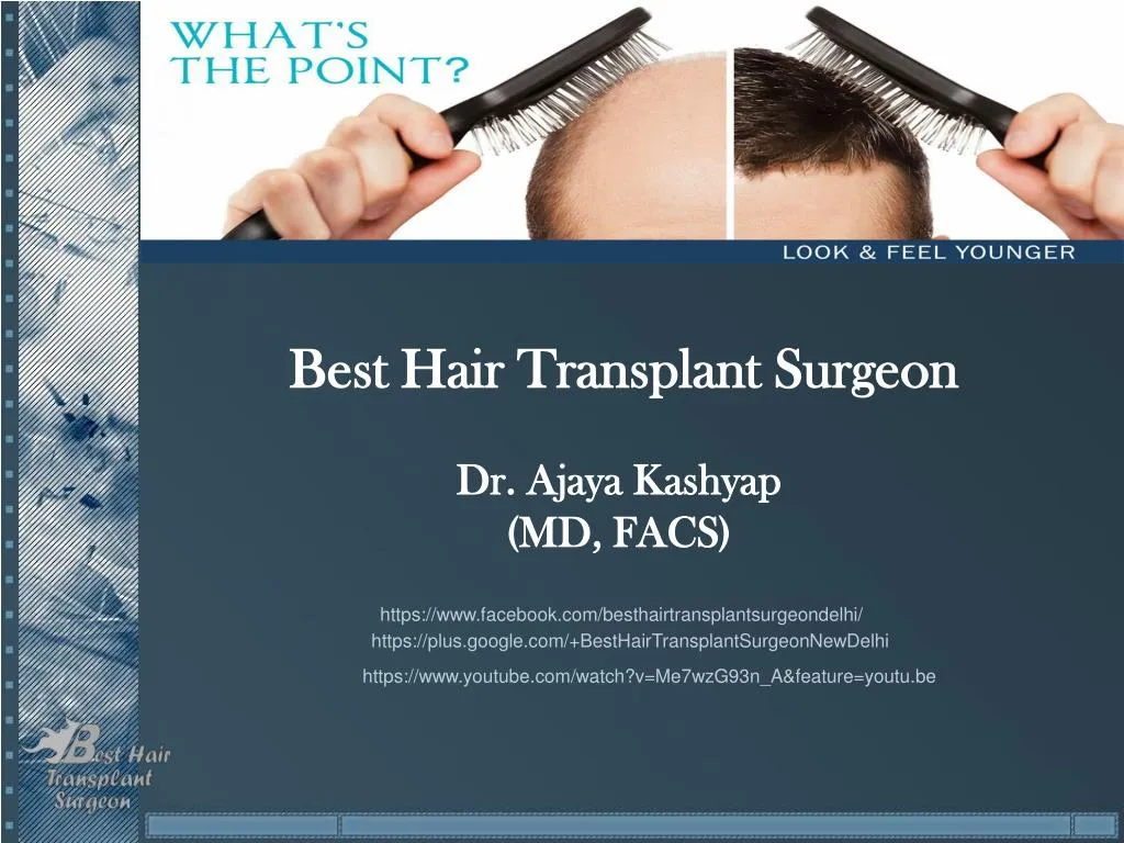 best hair transplant surgeon