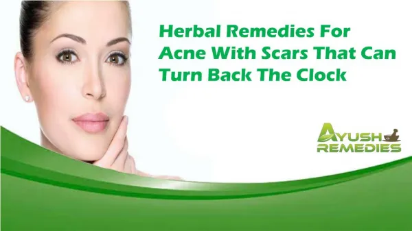Herbal Remedies For Acne With Scars That Can Turn Back The Clock