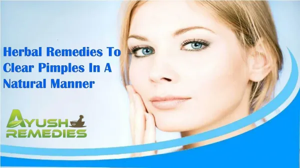 Herbal Remedies To Clear Pimples In A Natural Manner