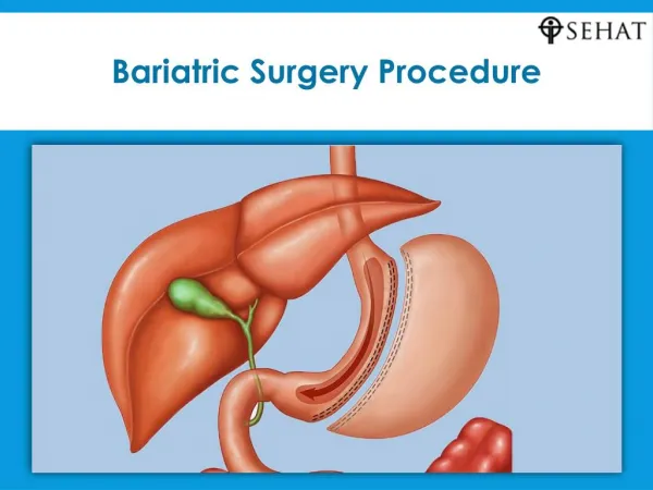 Bariatric surgery procedure