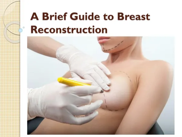 A Brief Guide to Breast Reconstruction